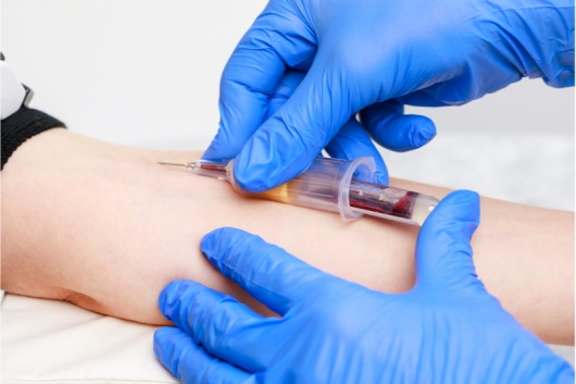 Blutentnahme - Behandlung, Wirkung & Risiken | Gesundpedia.de