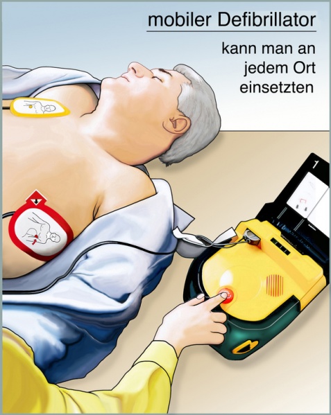 Datei:Defibrillator.jpg