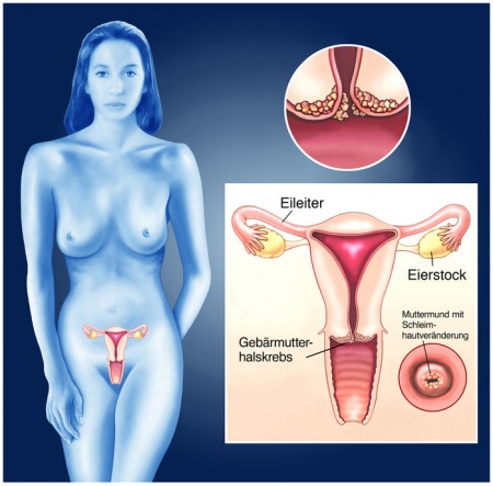 Gebärmuttermund Muttermund