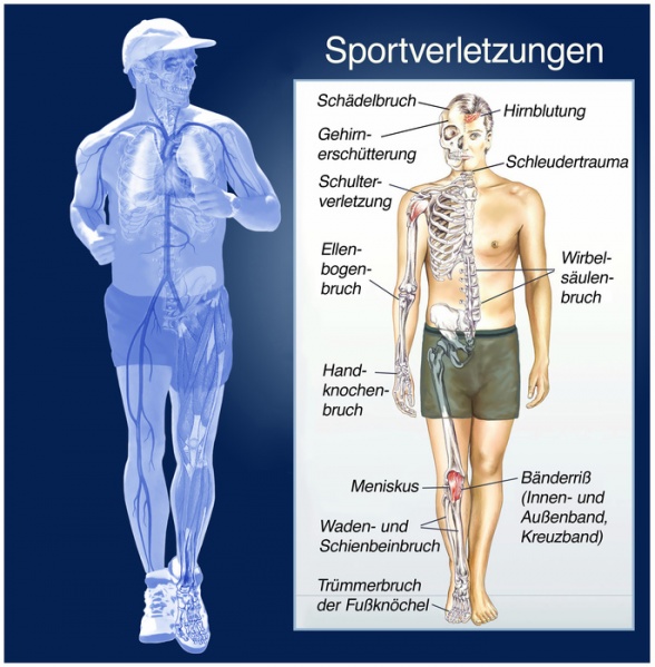 Datei:Sportverletzungen.jpg - Gesundheits-Ratgeber & Lexikon ...